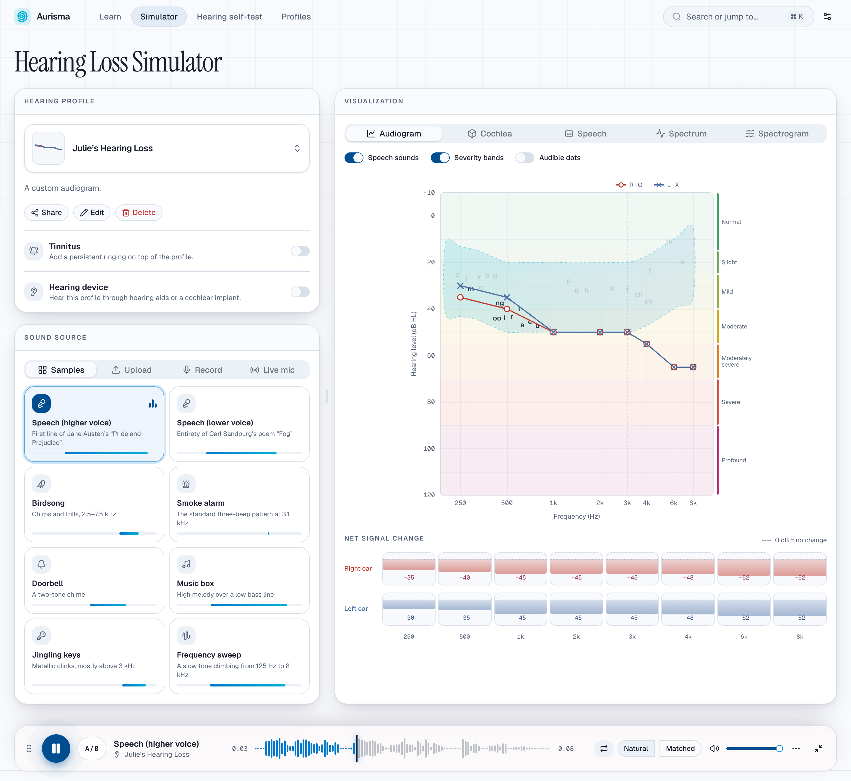 The Aurisma Hearing Loss Simulator interface, showing an audiogram, signal attenuation chart, sound sources, visualization options, and audio player.